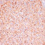 ATP Synthase gamma Antibody in Immunohistochemistry (Paraffin) (IHC (P))