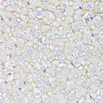 Catenin alpha-1 Antibody in Immunohistochemistry (Paraffin) (IHC (P))