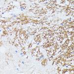 Catenin alpha-1 Antibody in Immunohistochemistry (Paraffin) (IHC (P))