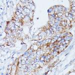 MANBA Antibody in Immunohistochemistry (Paraffin) (IHC (P))