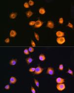 PRKAR2A Antibody in Immunocytochemistry (ICC/IF)