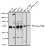 PRKAR2A Antibody in Western Blot (WB)