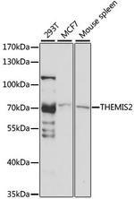 ICB-1 Antibody in Western Blot (WB)