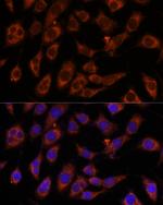 GFPT2 Antibody in Immunocytochemistry (ICC/IF)