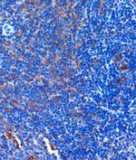 TCIRG1 Antibody in Immunohistochemistry (Paraffin) (IHC (P))