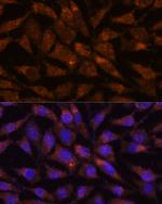 VIP36 Antibody in Immunocytochemistry (ICC/IF)