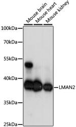 VIP36 Antibody in Western Blot (WB)