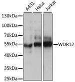 WDR12 Antibody in Western Blot (WB)