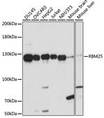 RBM25 Antibody in Western Blot (WB)