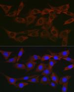 WNK3 Antibody in Immunocytochemistry (ICC/IF)