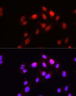 Hopx Antibody in Immunocytochemistry (ICC/IF)