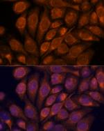 Importin 4 Antibody in Immunocytochemistry (ICC/IF)