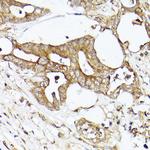 Acetyl-CoA Carboxylase Antibody in Immunohistochemistry (Paraffin) (IHC (P))