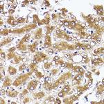 Acetyl-CoA Carboxylase Antibody in Immunohistochemistry (Paraffin) (IHC (P))