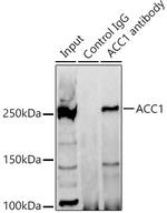 Acetyl-CoA Carboxylase Antibody in Immunoprecipitation (IP)