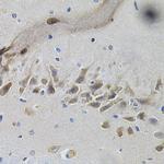 TrkA Antibody in Immunohistochemistry (Paraffin) (IHC (P))