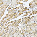 SLC25A5 Antibody in Immunohistochemistry (Paraffin) (IHC (P))