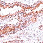 ENTPD6 Antibody in Immunohistochemistry (Paraffin) (IHC (P))