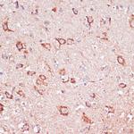 ENTPD6 Antibody in Immunohistochemistry (Paraffin) (IHC (P))