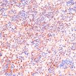 Cdc20 Antibody in Immunohistochemistry (Paraffin) (IHC (P))