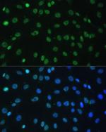 hnRNP D Antibody in Immunocytochemistry (ICC/IF)