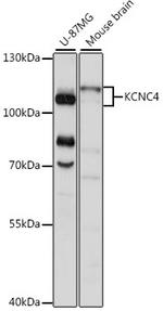 KV3.4 (KCNC4) Antibody in Western Blot (WB)