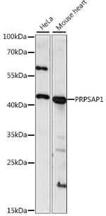 PRPSAP1 Antibody in Western Blot (WB)