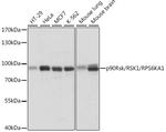 RSK1 Antibody in Western Blot (WB)