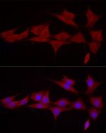 SGPL1 Antibody in Immunocytochemistry (ICC/IF)