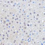 HCC1 Antibody in Immunohistochemistry (Paraffin) (IHC (P))