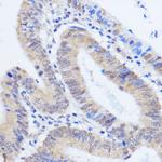 HCC1 Antibody in Immunohistochemistry (Paraffin) (IHC (P))