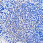 HCC1 Antibody in Immunohistochemistry (Paraffin) (IHC (P))