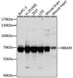 HCC1 Antibody in Western Blot (WB)