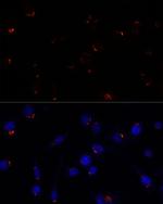 GOLGA5 Antibody in Immunocytochemistry (ICC/IF)