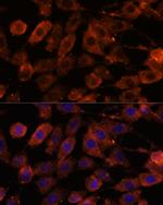 TENM1 Antibody in Immunocytochemistry (ICC/IF)