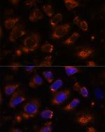 TENM1 Antibody in Immunocytochemistry (ICC/IF)