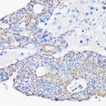 ACAA2 Antibody in Immunohistochemistry (Paraffin) (IHC (P))