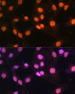 LSD1 Antibody in Immunocytochemistry (ICC/IF)