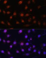 LSD1 Antibody in Immunocytochemistry (ICC/IF)