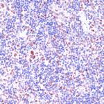 LSD1 Antibody in Immunohistochemistry (Paraffin) (IHC (P))