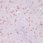 LSD1 Antibody in Immunohistochemistry (Paraffin) (IHC (P))