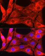 Galectin 1 Antibody in Immunocytochemistry (ICC/IF)