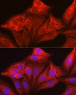 Galectin 1 Antibody in Immunocytochemistry (ICC/IF)