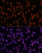 SF3B1 Antibody in Immunocytochemistry (ICC/IF)