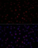 SF3B1 Antibody in Immunocytochemistry (ICC/IF)