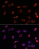 SF3B1 Antibody in Immunocytochemistry (ICC/IF)