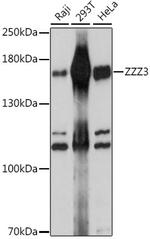 ZZZ3 Antibody in Western Blot (WB)