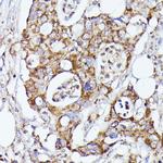 CDK5RAP1 Antibody in Immunohistochemistry (Paraffin) (IHC (P))