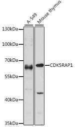 CDK5RAP1 Antibody in Western Blot (WB)