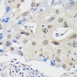 UCKL1 Antibody in Immunohistochemistry (Paraffin) (IHC (P))